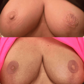 Восстановление ареолы груди с помощью татуажа: уникальная процедура в студии ПМ.